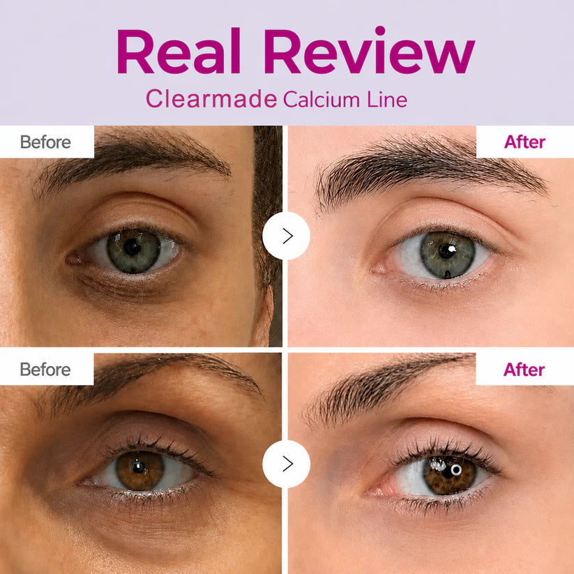 🔥LAST DAY 50% OFF!! Clearmade Korean Calcium Dark Spot Eye Cream