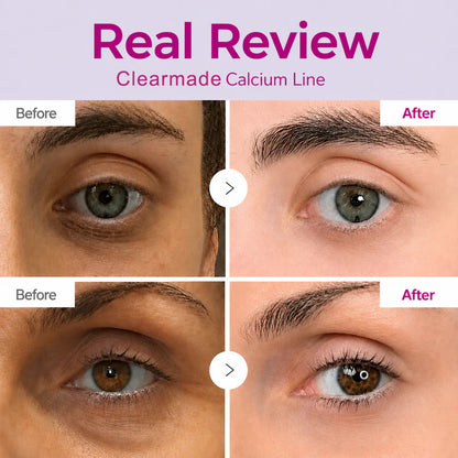 🔥LAST DAY 50% OFF!! Clearmade Korean Calcium Dark Spot Eye Cream