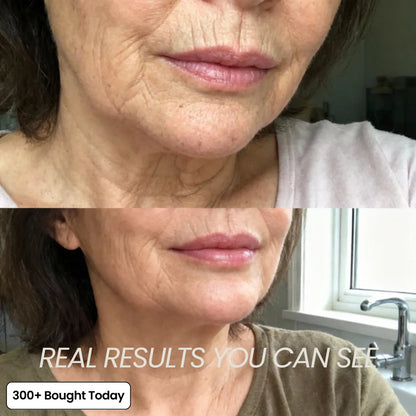 🔥🔥LAST DAY 60% OFF Clearmade Korean Pink Collagen Volume Multi Balm